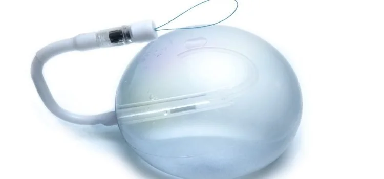 Spatz3 adjustable gastric balloon